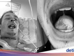 Fakta-fakta Pria Hingga Inggris Idap Kanker Mulut, Awalnya Cuma Ngeluh Sariawan