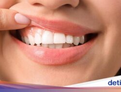 Tanda-Tanda Kanker Mulut yang Kerap Tak Disadari, Termasuk Sariawan