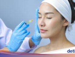 Mencoba Treatment Exosome, Ini Hasil Setelahnya 2 Minggu