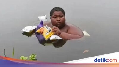 Remaja Ini Berendam Hingga Kolam Pada 5 Tahun Sebab Kulit Terasa Terbakar