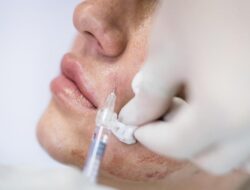 Viral Di Sosmed, Skin Booster Kolagen Korsel Ini Pakai Jaringan Kulit Mayat