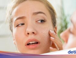 Kulit Masih Kering Meski Pakai Moisturizer? Ternyata Ini 9 Penyebabnya