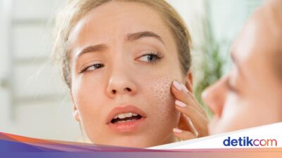 Kulit Masih Kering Meski Pakai Moisturizer? Ternyata Ini 9 Penyebabnya